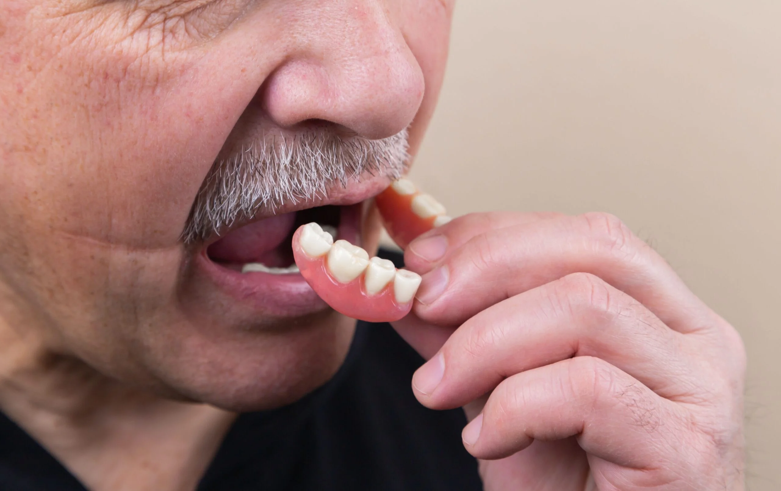 Do Fake Teeth Decay? Details on Correct Prosthetic Care | KewDentistry